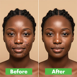 Aloe Vera Leaf Fade Dark Spot Cream